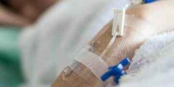 Vigilancia epidemiológica ante casos del “Síndrome de Guillain Barré”